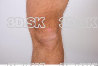 Danas knee 0003